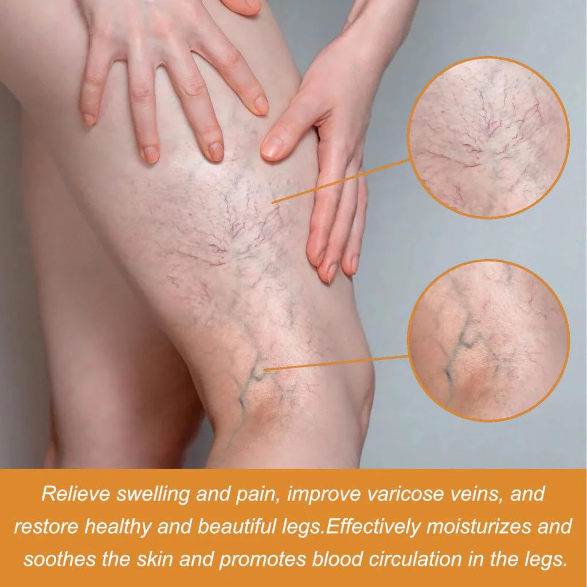 GoReady® Varicose Veins Spray – Natural Herbal Relief Reduces Swelling, Relieves Pain Spray  (30 ml)