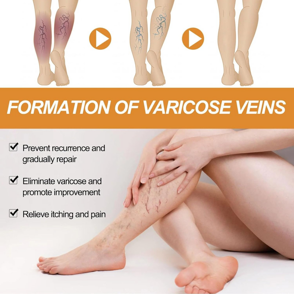 GoReady® Varicose Veins Spray – Natural Herbal Relief Reduces Swelling, Relieves Pain Spray  (30 ml)
