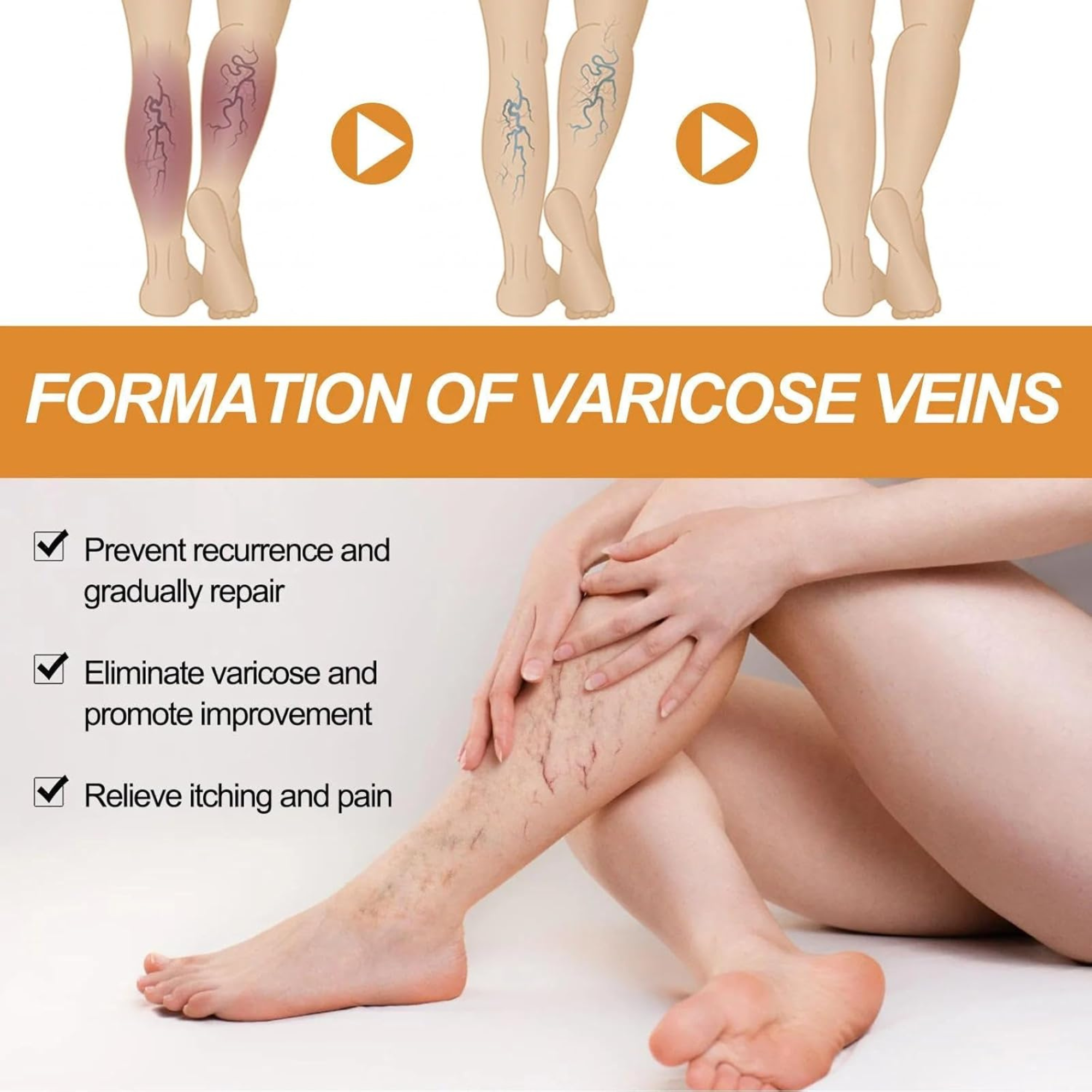 GoReady® Varicose Veins Spray – Natural Herbal Relief Reduces Swelling, Relieves Pain Spray  (30 ml)
