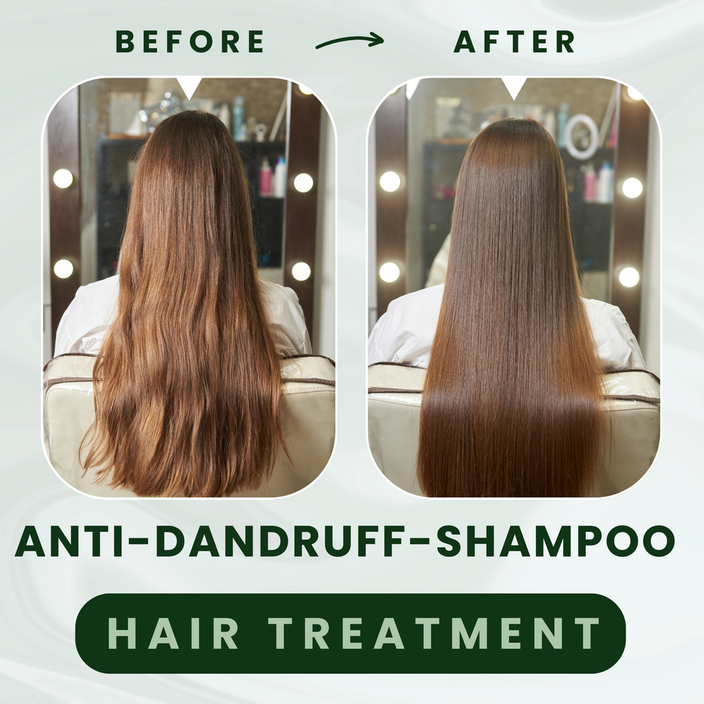 GoReady® Anti-Dandruff Shampoo - Strengthens Hair with Salicylic Acid & Biotin  (250 ml)