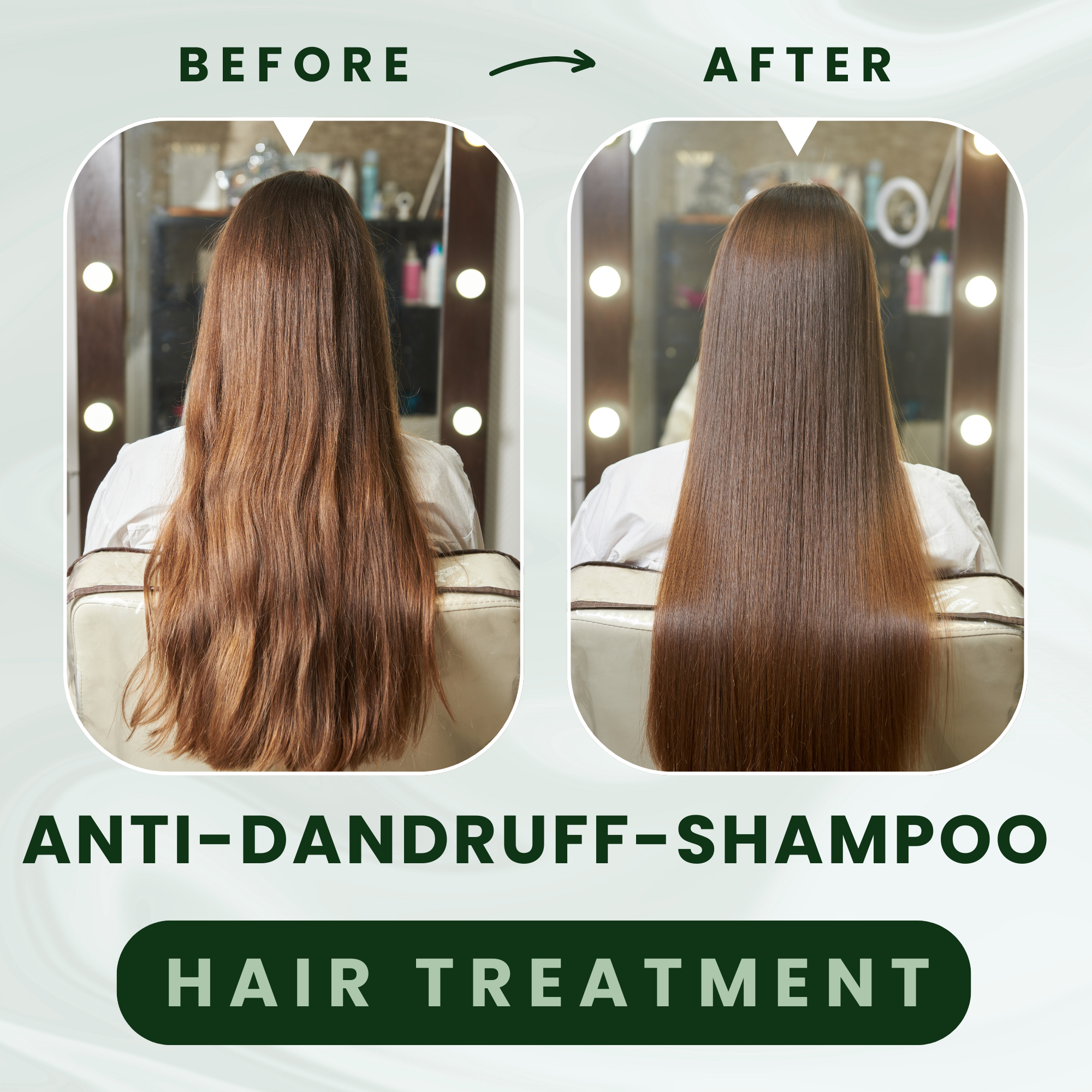 GoReady® Anti-Dandruff Shampoo - Strengthens Hair with Salicylic Acid & Biotin  (250 ml)