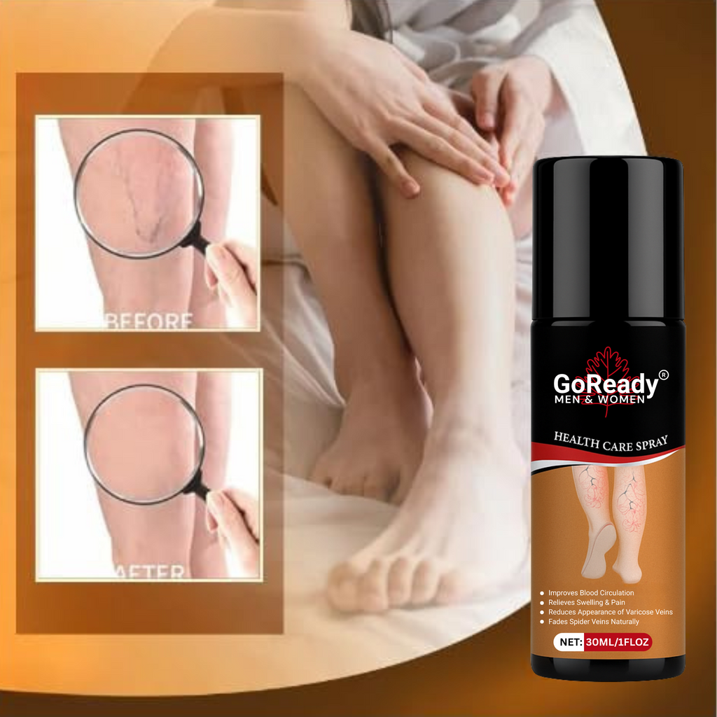 GoReady® Varicose Veins Spray – Natural Herbal Relief Reduces Swelling, Relieves Pain Spray  (30 ml)