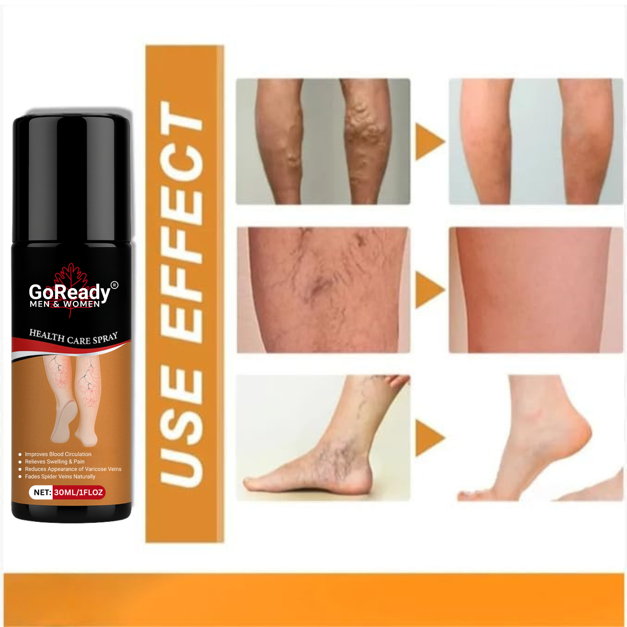 GoReady® Varicose Veins Spray – Natural Herbal Relief Reduces Swelling, Relieves Pain Spray  (30 ml)